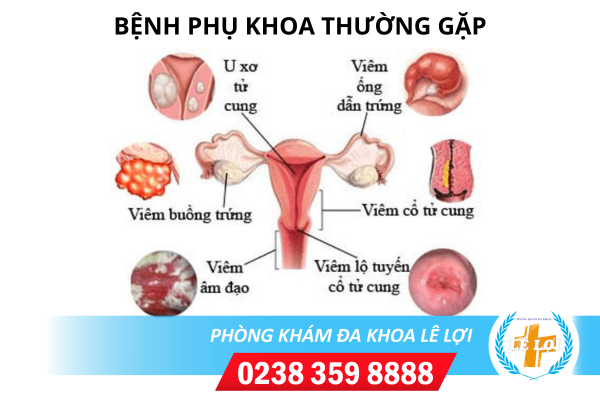 Các bệnh phụ khoa thường gặp ở nữ và cách điều trị