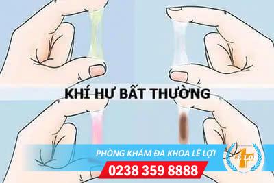 Các bệnh khí hư thường gặp dấu hiệu và cách điều trị