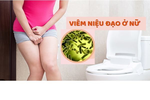 Viêm niệu đạo nữ và những thông tin cần biết