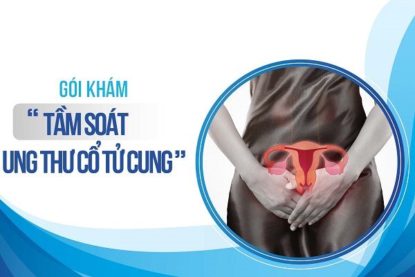 Tầm soát ung thư cổ tử cung được thực hiện ra sao?