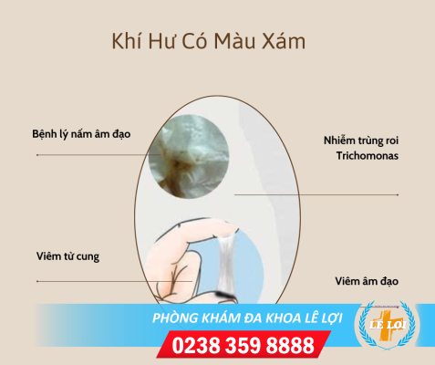 Khí Hư Màu Xám Cảnh Báo Bệnh Gì?