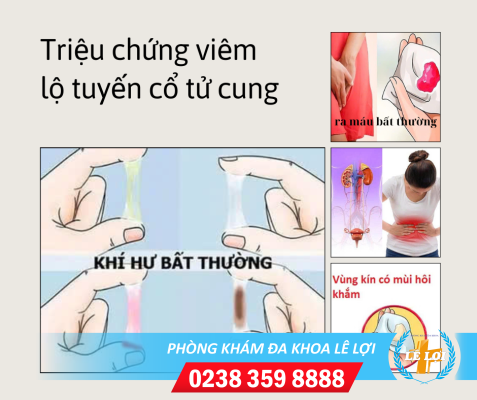 Triệu chứng lộ tuyến cổ tử cung