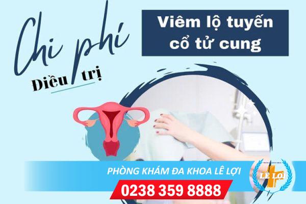 Chi phí trị viêm lộ tuyến bao nhiêu?