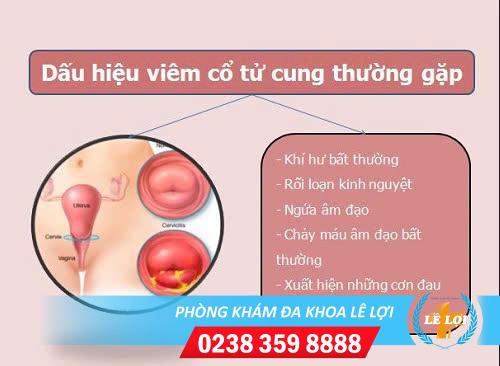 Dấu hiệu viêm tử cung chị em cần biết