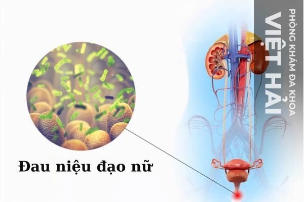 Đau Niệu Đạo Ở Nữ – Dấu Hiệu Bệnh Viêm Đường Tiết Niệu