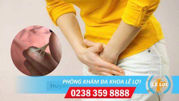 Huyết Trắng Đặc Là Dấu Hiệu Bệnh Lý Gì?