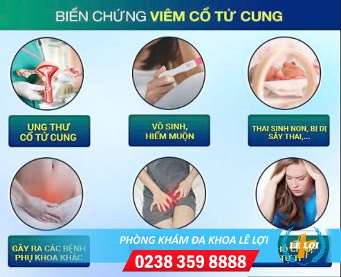 Viêm Cổ Tử Cung Nguy Hiểm Như Thế Nào?