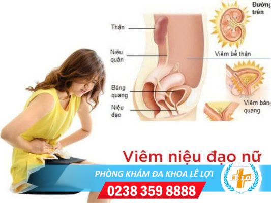 Phương Pháp Điều Trị Viêm Niệu Đạo Nữ Hiệu Quả