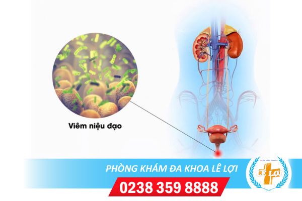 Phòng Khám Niệu Đạo Uy Tín Hàng Đầu Hiện Nay Tại TP.Vinh