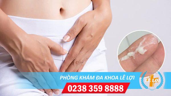 Mảng bám âm hộ, mảng bám vùng kín là bị bệnh gì?