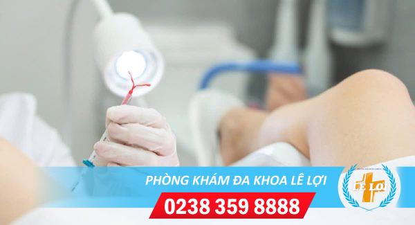 Tháo vòng tránh thai an toàn hiệu quả