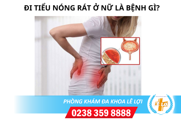 Đi tiểu nóng rát ở nữ