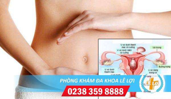 Tức bụng dưới ở phụ nữ là bệnh gì?