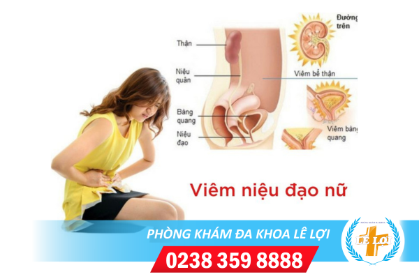 Xét nghiệm viêm niệu đạo