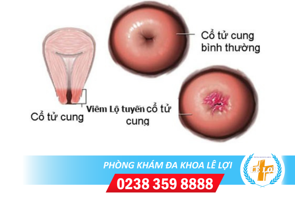 Thiết kế chưa có tên (4)