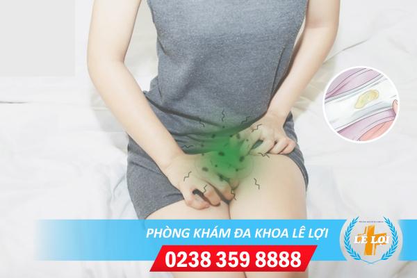 Vùng kín ra dịch có mùi hôi, mùi tanh là bị bệnh gì?