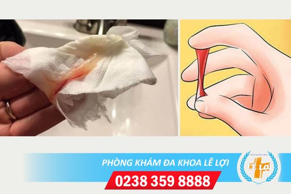 Huyết trắng có máu là bị bệnh gì?