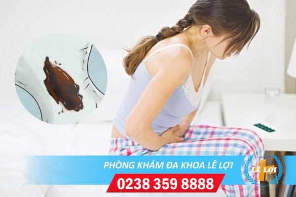 Âm đạo ra dịch mủ là dấu hiệu bệnh gì?