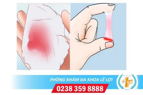 Khí hư màu hồng là dấu hiệu bệnh gì?