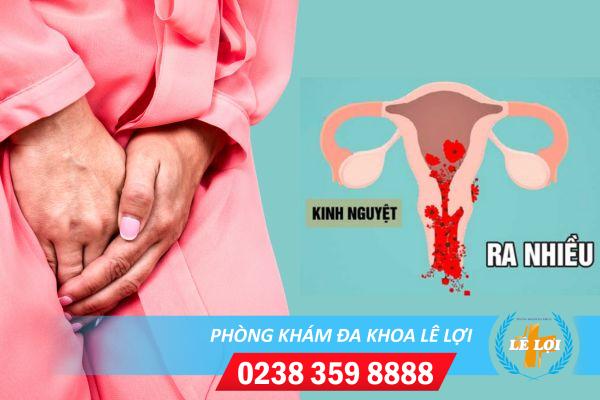 Kinh nguyệt ra nhiều có ảnh hưởng gì không?