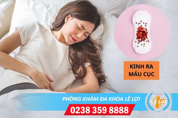 Kinh ra máu cục có phải mắc bệnh không?