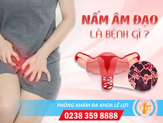 Cách chữa nấm âm đạo hiệu quả hiện nay